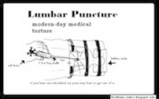 Бесплатно скачать люмбальную+пункцию бесплатное фото или картинку для редактирования с помощью онлайн-редактора изображений GIMP