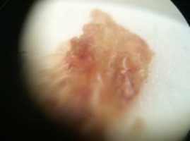 Free download meat_timothytrespas-evil-is-visible-scab-eaten-by-mites-and-weaponized-biology free photo or picture to be edited with GIMP online image editor
