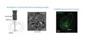 Free download microendoscope free photo or picture to be edited with GIMP online image editor