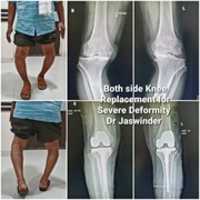 Free download Orthopedic Surgeon in Patna free photo or picture to be edited with GIMP online image editor