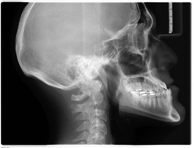Free download xray x ray radiology scan free picture to be edited with GIMP free online image editor