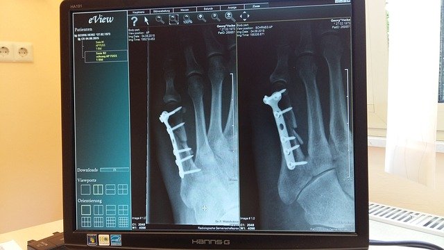 Free download roentgen x ray image clinic free picture to be edited with GIMP free online image editor