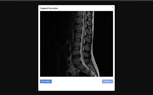 Bionic Spine  from Chrome web store to be run with OffiDocs Chromium online