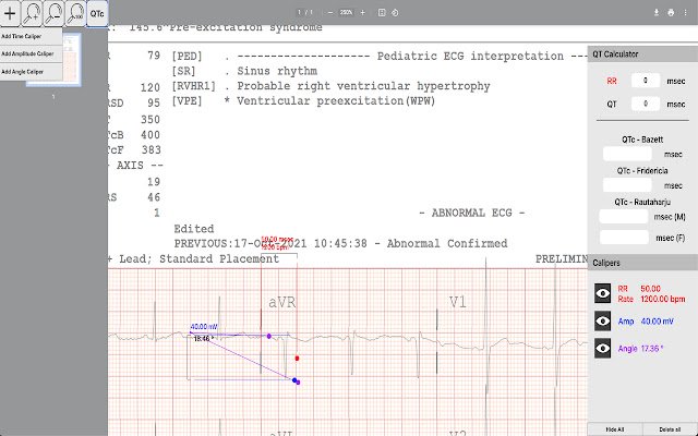 Caliper App  from Chrome web store to be run with OffiDocs Chromium online