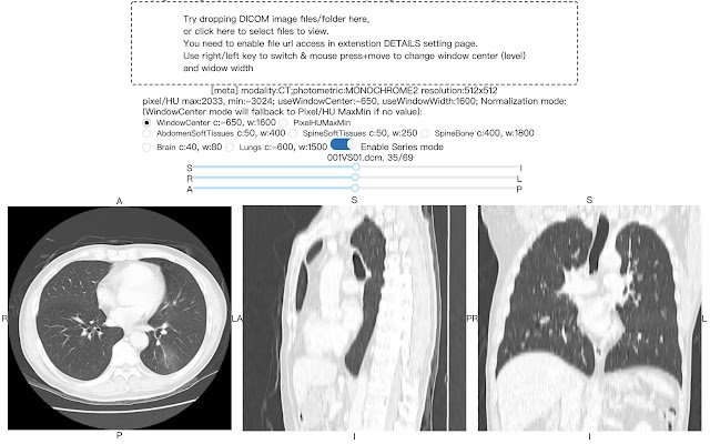 โปรแกรมดูรูปภาพ DICOM จาก Chrome เว็บสโตร์ที่จะรันด้วย OffiDocs Chromium ออนไลน์