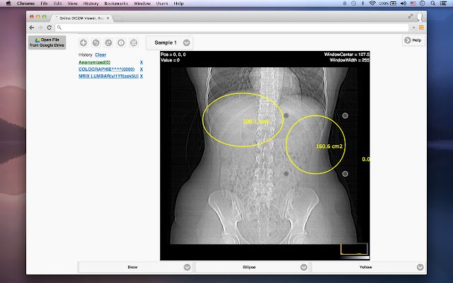 El lector de imágenes médicas DICOM de la tienda web de Chrome se ejecutará con OffiDocs Chromium en línea