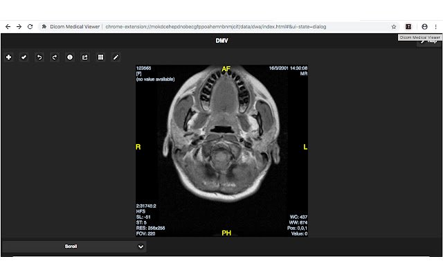 Chrome 网上商店的 Dicom Medical Viewer 将与 OffiDocs Chromium 在线一起运行