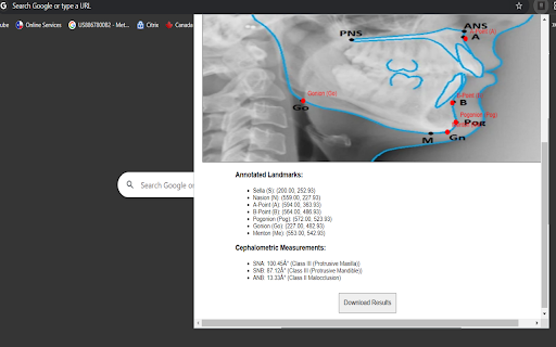 Lateral Cephalometric Analysis  from Chrome web store to be run with OffiDocs Chromium online