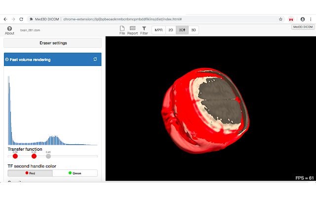 Med3D DICOM van de Chrome-webwinkel om te worden uitgevoerd met OffiDocs Chromium online