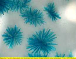 Free download Spherulites of synthetic chalconatronite (3) free photo or picture to be edited with GIMP online image editor
