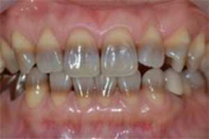 Free download Tetracycline free photo or picture to be edited with GIMP online image editor
