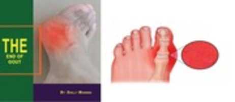 Free download The End Of GOUT Program free photo or picture to be edited with GIMP online image editor