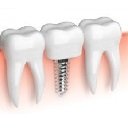 Nangungunang Dental Implant Services screen para sa extension ng Chrome web store sa OffiDocs Chromium
