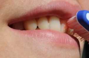 Free download What are some ways to improve oral health? free photo or picture to be edited with GIMP online image editor