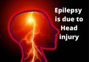 Free download What Is The Meaning Of epilepsy free photo or picture to be edited with GIMP online image editor