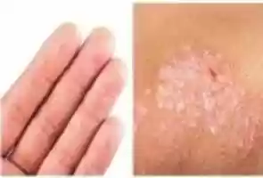 Free download 41307-20160704 free photo or picture to be edited with GIMP online image editor