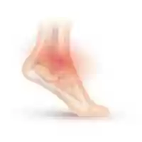 Free download Ankle Sprain free photo or picture to be edited with GIMP online image editor