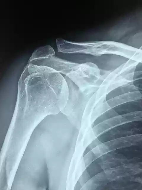 Free download arm healthy rotator cuff pain free picture to be edited with GIMP free online image editor