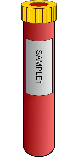 Free download Blood Sample Tube - Free vector graphic on Pixabay free illustration to be edited with GIMP free online image editor