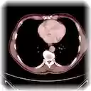 Dicom Medical Viewer  screen for extension Chrome web store in OffiDocs Chromium