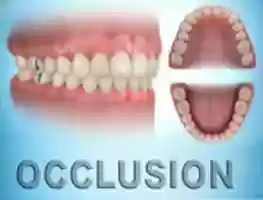 Free download Occlusion free photo or picture to be edited with GIMP online image editor