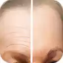 Reduce Forehead Wrinkles  screen for extension Chrome web store in OffiDocs Chromium