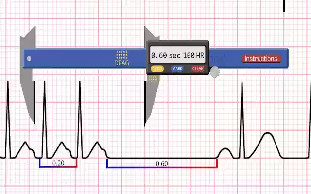 Apex EKG Caliper  from Chrome web store to be run with OffiDocs Chromium online