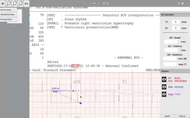 Caliper App from Chrome web store to be run with OffiDocs Chromium online Caliper App from Chrome web store to be run with OffiDocs Chromium online