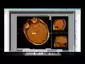 โปรแกรมดูรูปภาพ DICOM จาก Chrome เว็บสโตร์ที่จะรันด้วย OffiDocs Chromium ออนไลน์