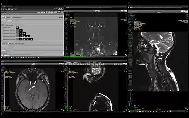 Hyland NilRead WinMan from Chrome web store to be run with OffiDocs Chromium online Hyland NilRead WinMan from Chrome web store to be run with OffiDocs Chromium online
