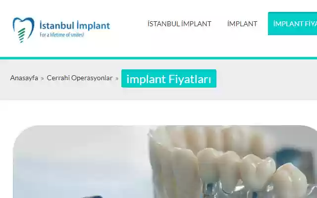 implantdental  from Chrome web store to be run with OffiDocs Chromium online