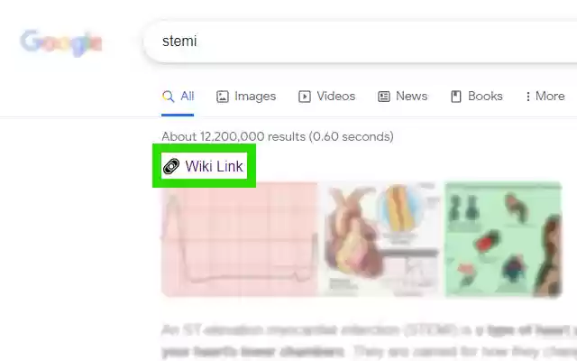 Link2Wiki from Chrome web store to be run with OffiDocs Chromium online Link2Wiki from Chrome web store to be run with OffiDocs Chromium online