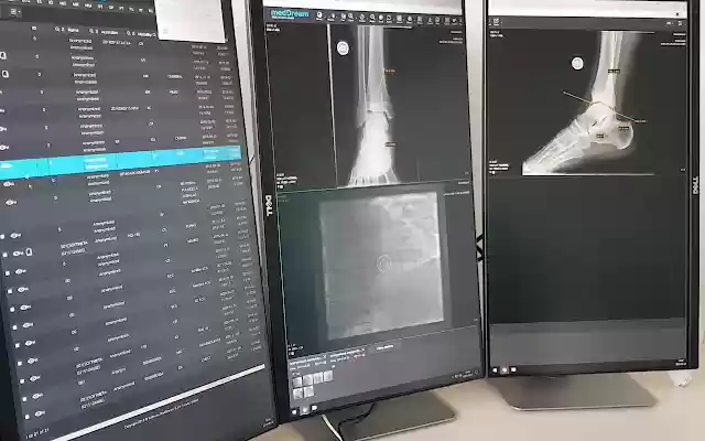 Med Source Multi Monitor MedDream browser extension for multi monitors in