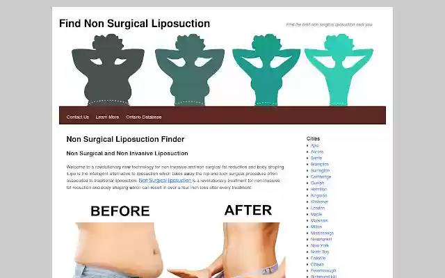 Chrome web mağazasından Cerrahi Olmayan Liposuction Bulucu, OffiDocs Chromium çevrimiçi ile çalıştırılacak