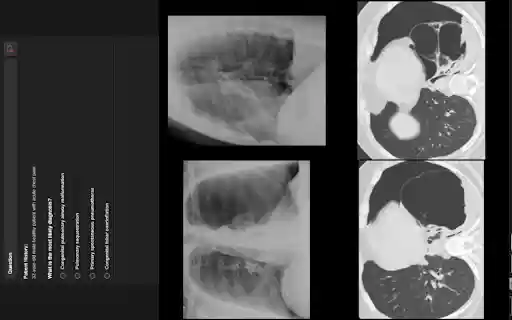 RADPrimer with Enhancement from Chrome web store to be run with OffiDocs Chromium online RADPrimer with Enhancement from Chrome web store to be run with OffiDocs Chromium online