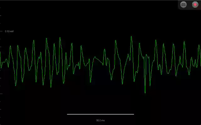Spike Recorder  from Chrome web store to be run with OffiDocs Chromium online