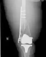 Free download Some of the metal to rebuild me free photo or picture to be edited with GIMP online image editor